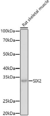 Western Blot: SIX2 AntibodyAzide and BSA Free [NBP2-94801]